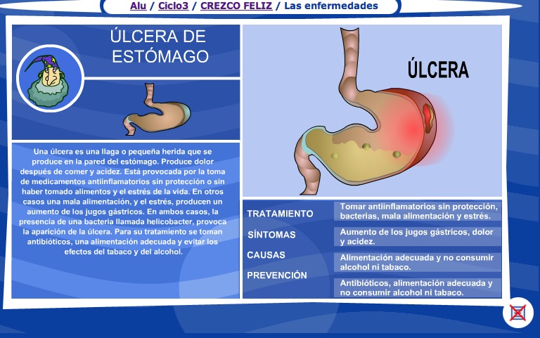 La úlcera de estómago | Recurso educativo 36013