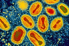 Destruction of smallpox virus delayed | Recurso educativo 71726