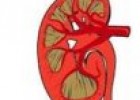Trastornos metabólicos y congénitos del riñón | Recurso educativo 79768