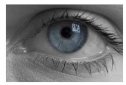 Lesiones oculares | Recurso educativo 81470