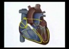 Ciclo Cardiaco | Recurso educativo 117384