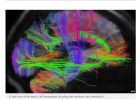 The  Human Connectome Project | Recurso educativo 746691